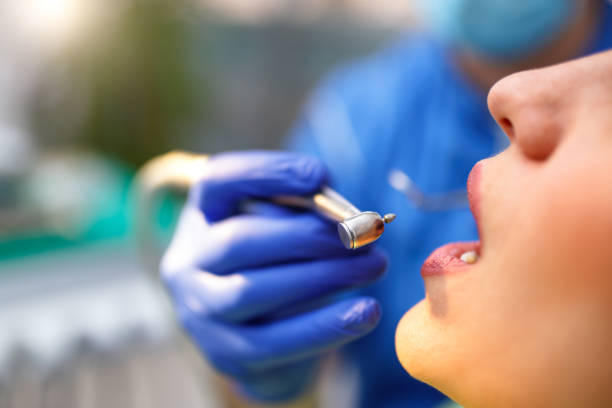 Dental Bonding in Atlantic City, NJ